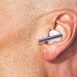 My ears are too big as a result of which I have to cover them. Can I get them operated?