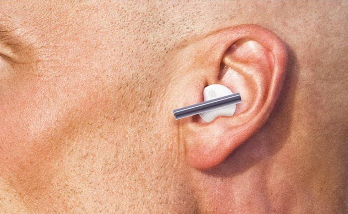 My ears are too big as a result of which I have to cover them. Can I get them operated?