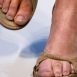 My feet swell in the hot weather. Why is it so?