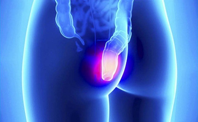 Top 10 Unani Medicines for Treatment of Piles