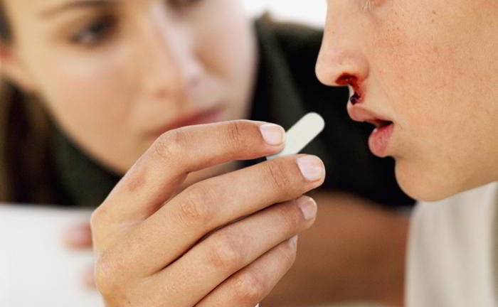 What are the cause of nose bleeding?