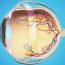 What are the symptoms of detached retina?