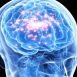 What do we mean by epilepsy?