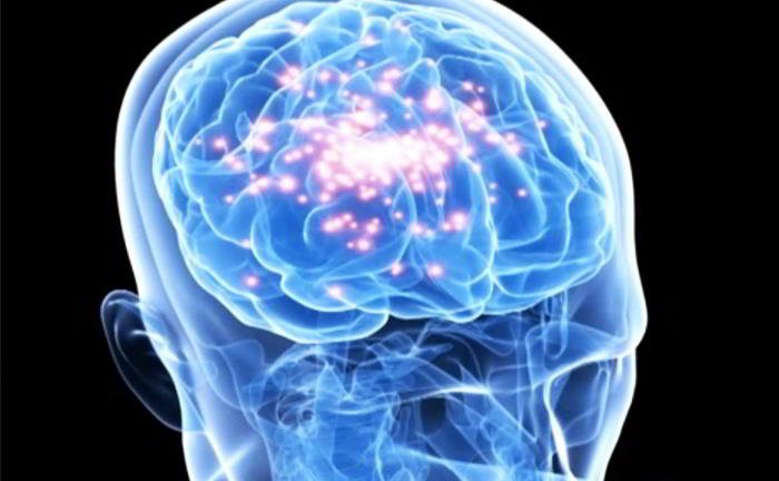 What do we mean by epilepsy?