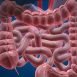 What do you mean by colitis?