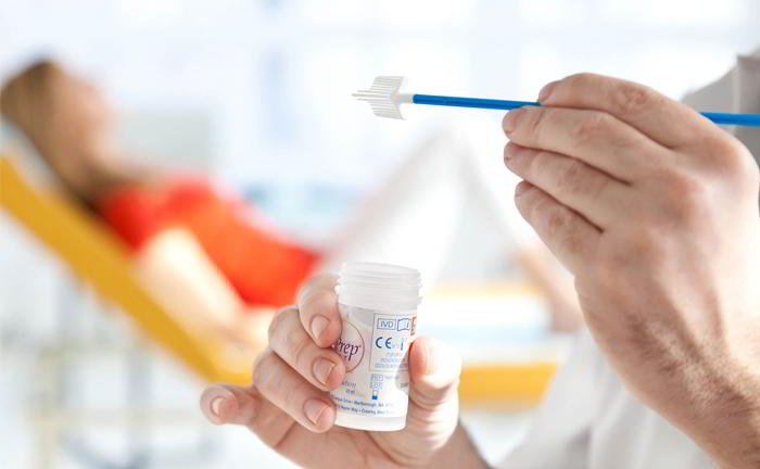 What is a smear-test?