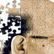 What is Alzheimer's disease?
