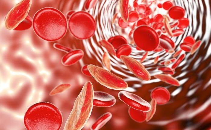 What is anaemia?