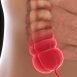What is appendix?