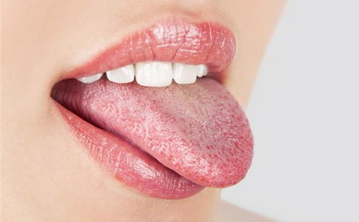 What is Candida and thrush?