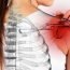 What is meant by 'frozen' shoulder?