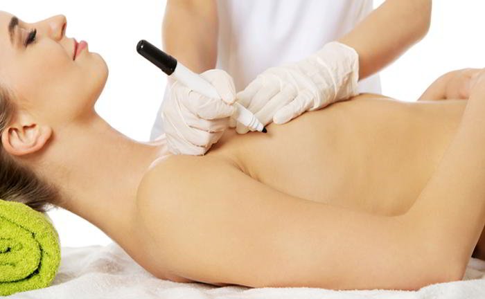 What is 'partial' mastectomy?