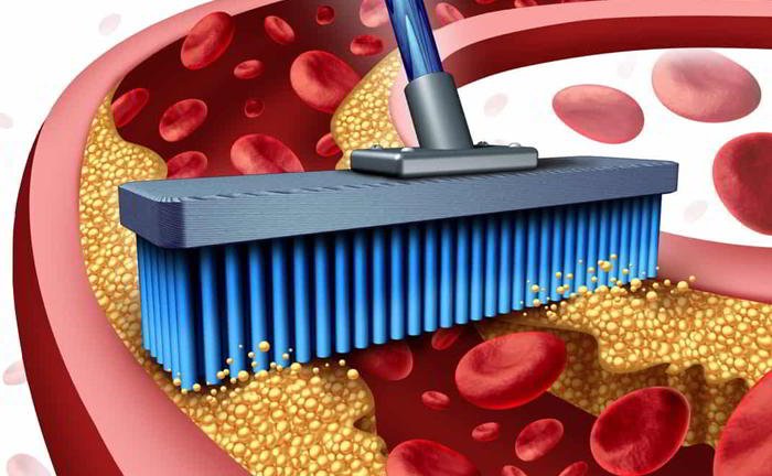 What is the treatment for angina?