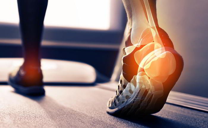 Where is Achilless tendon found in the body?