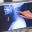 Why barium meal essential to get the stomach examined by the doctor?