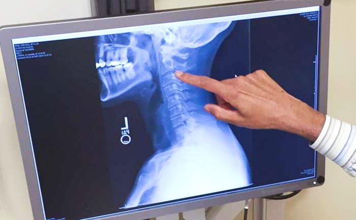 Why barium meal essential to get the stomach examined by the doctor?