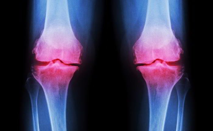 Why does Osteoarthritis take place?